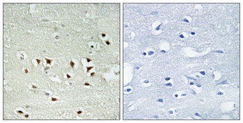 MAPKAPK-2 (phospho-Thr334) antibody