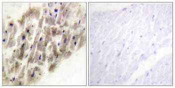 MAPKAPK-2 (phospho Thr222) rabbit pAb