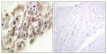 MAPKAPK-2 (phospho-Thr222) antibody