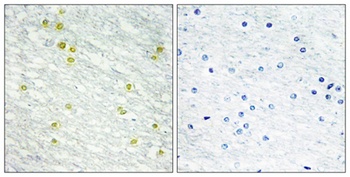 CRSP150 antibody