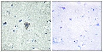 GPR37L1 antibody