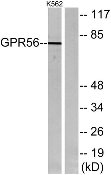 GPR56 rabbit pAb