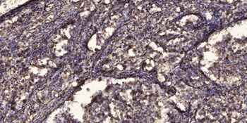 SFRS11 antibody