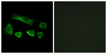 AIRP rabbit pAb Antibody