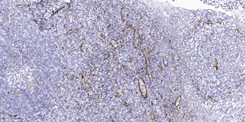 AIRP rabbit pAb Antibody
