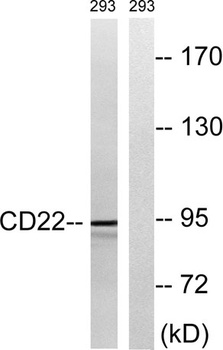CD22 rabbit pAb Antibody