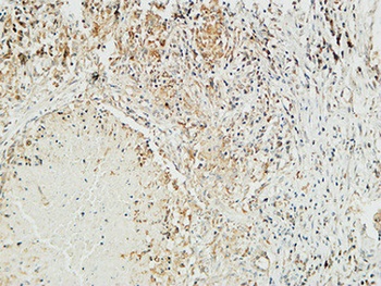 Mucin 16 antibody