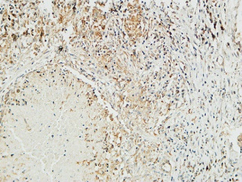 Mucin 16 rabbit pAb
