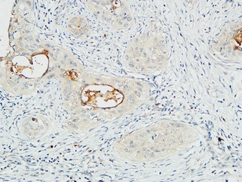 Mucin 16 antibody