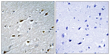 HAND1 antibody