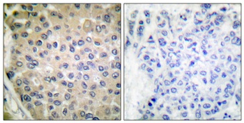 CPI-17 (phospho Thr38) rabbit pAb