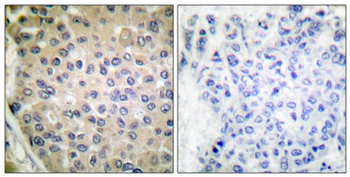 CPI-17 (phospho-Thr38) antibody