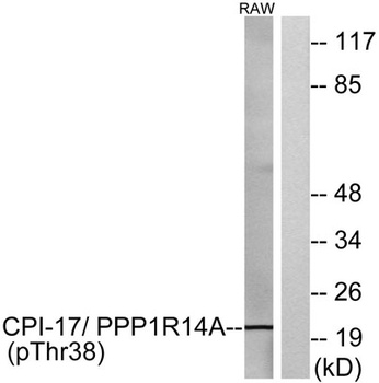 CPI-17 (phospho-Thr38) antibody
