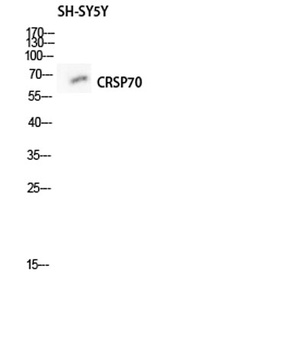 CRSP70 rabbit pAb
