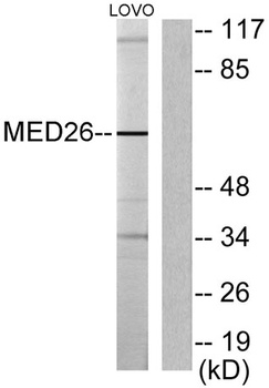 CRSP70 rabbit pAb