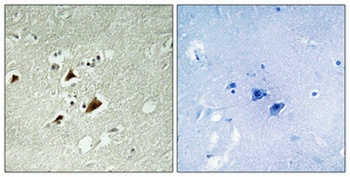 JIP-1 (phospho Thr103) rabbit pAb