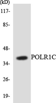 RPA40 rabbit pAb