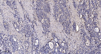 X11γ rabbit pAb