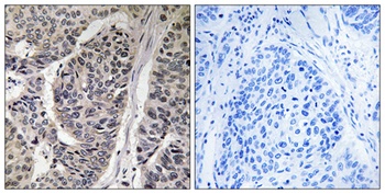 p130 Cas (phospho Tyr410) rabbit pAb
