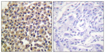 p130 Cas (phospho-Tyr249) antibody