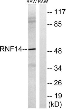 ARA54 rabbit pAb Antibody
