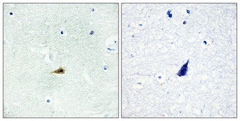 SMRTe rabbit pAb