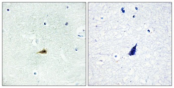 SMRTe antibody