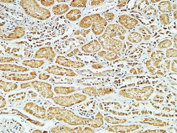 CD79a antibody