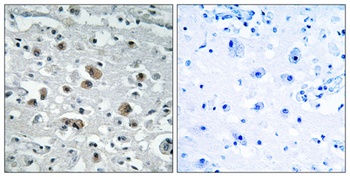 GASP-1 antibody