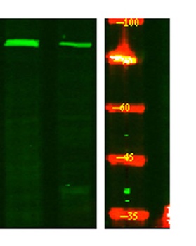 ACAP1 (phospho-Ser554) antibody