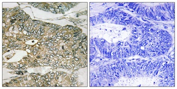 Gab 2 (phospho Ser159) rabbit pAb
