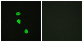 TBC1D4 (phospho Thr642) rabbit pAb
