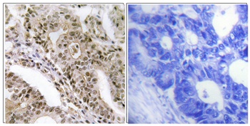 TBC1D4 (phospho-Thr642) antibody