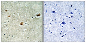 Arnt 2 rabbit pAb Antibody