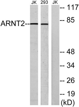 Arnt 2 antibody