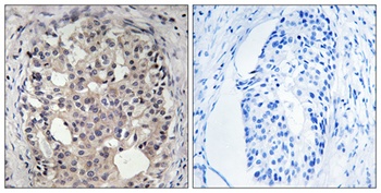 Cdc25A (phospho Ser178) rabbit pAb