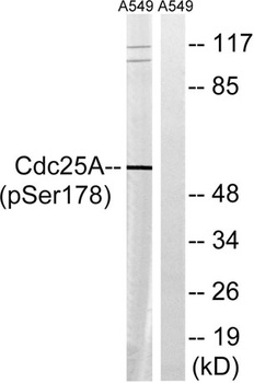 Cdc25A (phospho-Ser178) antibody