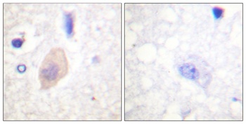 Cdc25B (phospho-Ser353) antibody