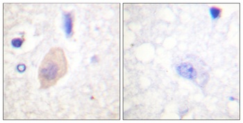 Cdc25B (phospho Ser353) rabbit pAb