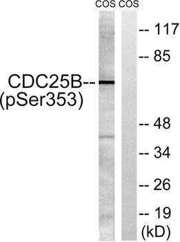 Cdc25B (phospho-Ser353) antibody