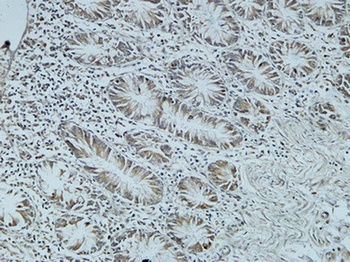 Cdc25B antibody