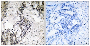 Cdc25C (phospho Ser198) rabbit pAb