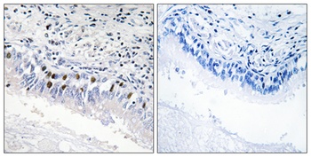 TRAP230 rabbit pAb Antibody
