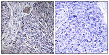 hnRNP DL rabbit pAb Antibody