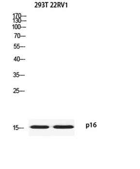 p16 rabbit pAb Antibody