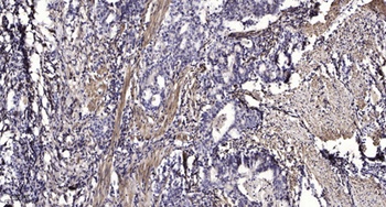 PI 3-Kinase C2γ rabbit pAb Antibody