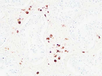 Karyopherin α2 rabbit pAb