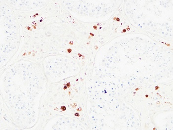 Karyopherin alpha 2 antibody