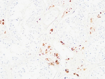 Karyopherin α2 rabbit pAb