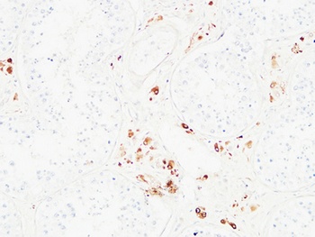 Karyopherin alpha 2 antibody